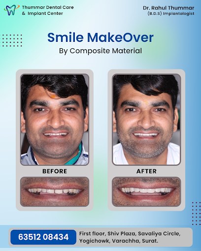 Smile makeover — Composite material